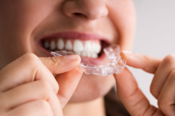 Expert Root Canal Treatment In Woodbridge, Va – Gentle Care, Healthy Smiles!